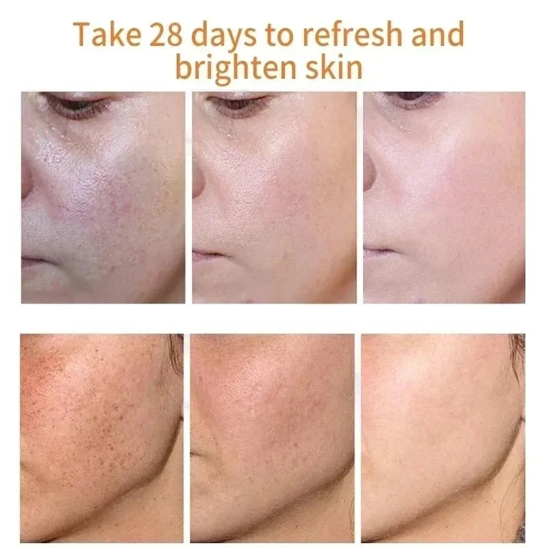 bellisse "Brighten & Even Your Skin with Fades Freckle Cream"