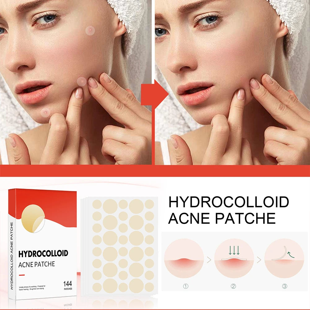 Bellisse-β’ Mighty Patch Original patch1 Hydrocolloid