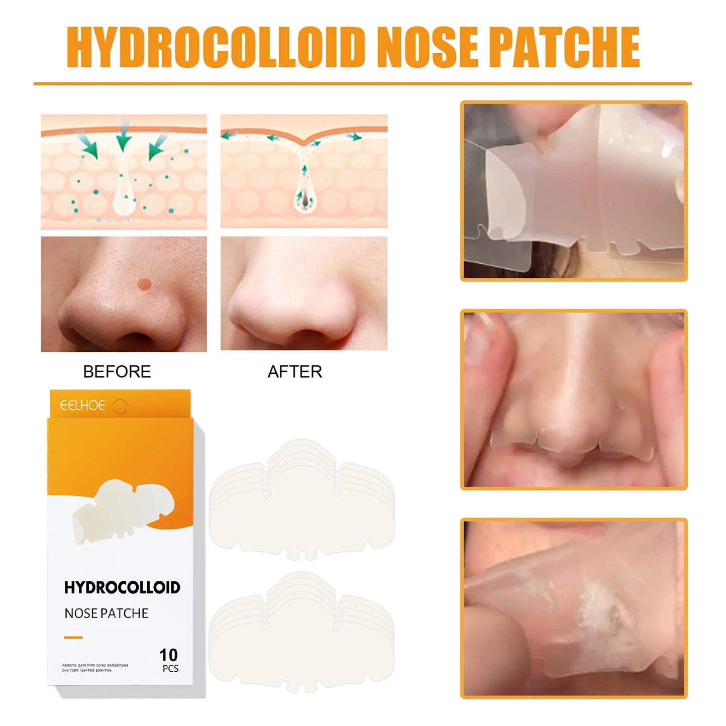 Bellisse™Mighty Patch Nose: Hydrocolloid anti